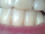 080707.clean_teeth_t.gif