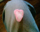 060226.heartknee_t.gif