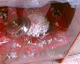 060818.Heart2_t.gif