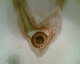 070115.H_limescale_heart_t.gif